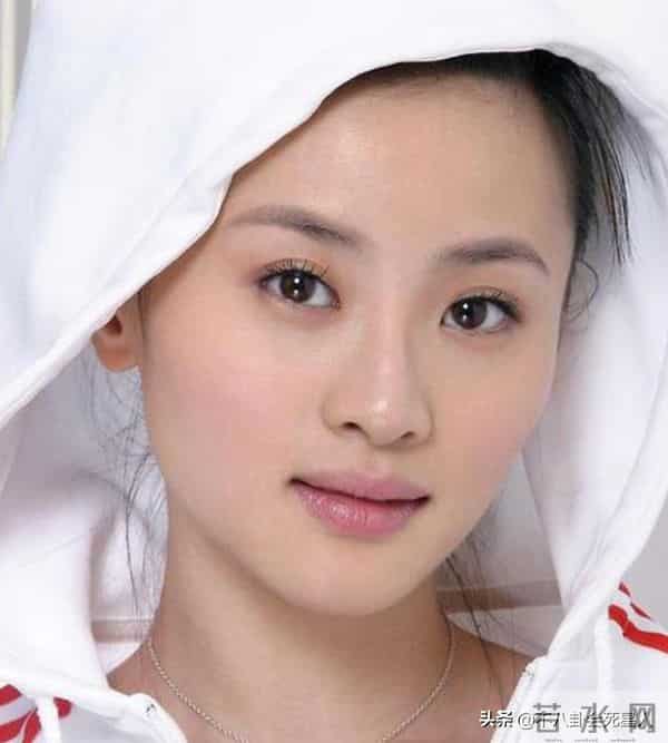 张芷溪整容前后