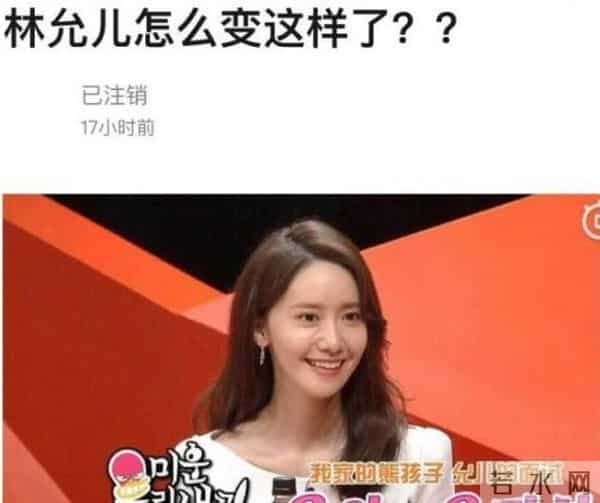 林允儿整容前后