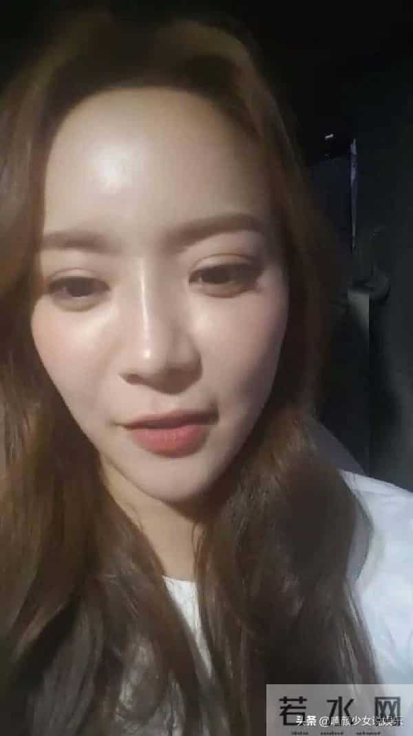 张瑞希整容失败