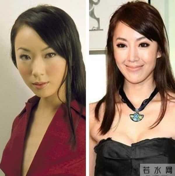 张馨予整容前