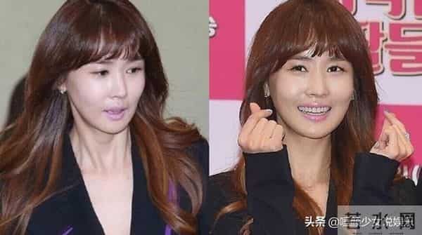 张瑞希整容失败