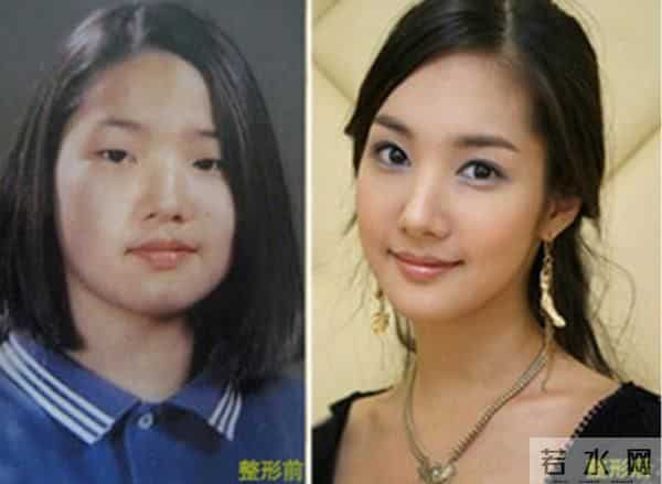 朴敏英整容前照片