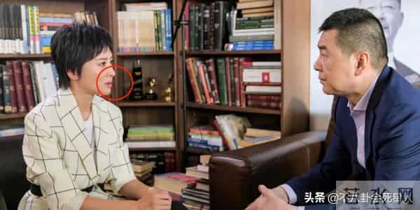 张芷溪整容前后