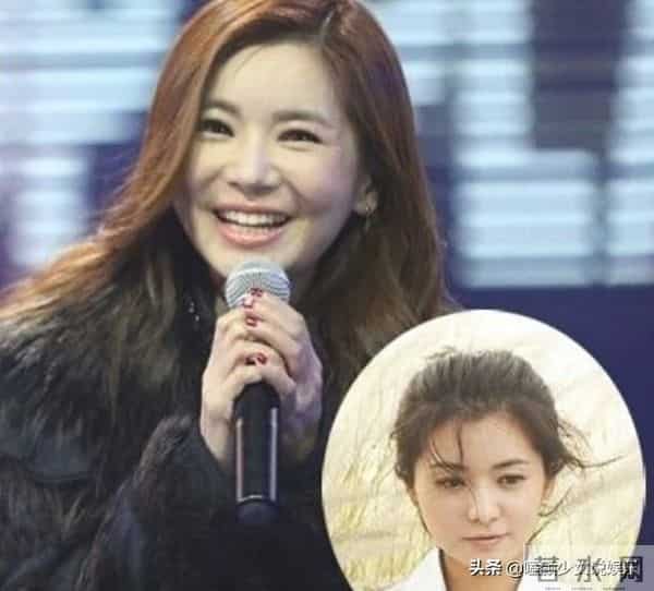 张瑞希整容失败