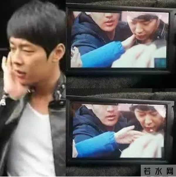 唐安琪烧伤再出新内幕