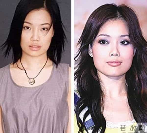 张馨予整容前