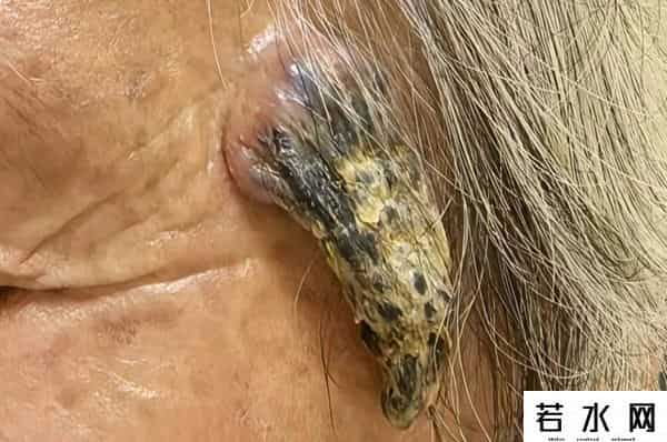 羊了个羊是啥,浙江女子头上长山羊角?真的!别抠,会坏事……