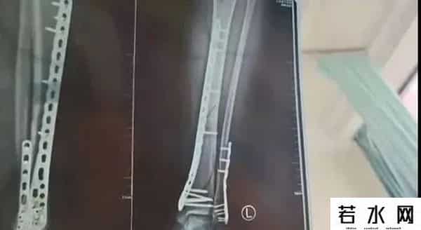 艺人代言,卖不动了?一夜暴跌近30%!众多明星代言!该品类屡被曝伤害事故……