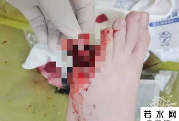 艺人代言,卖不动了?一夜暴跌近30%!众多明星代言!该品类屡被曝伤害事故……