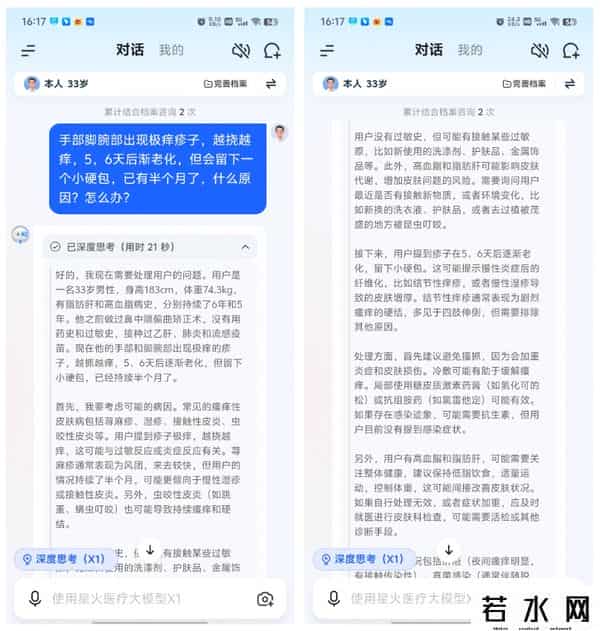 it健康,讯飞晓医体验评测:星火医疗大模型X1加持,更懂你的AI健康助手