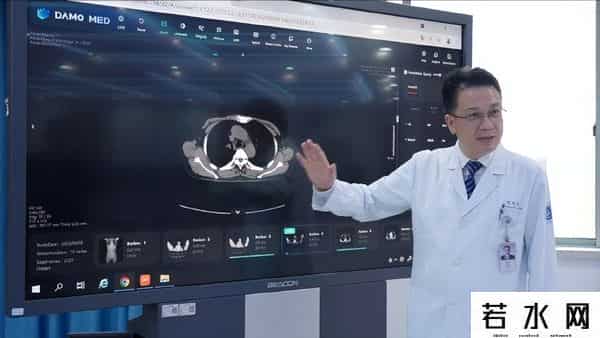 31名CHATGPT派遣工遭解雇