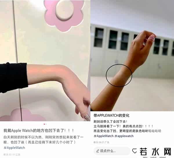 官方回应戴苹果手表手会凹陷