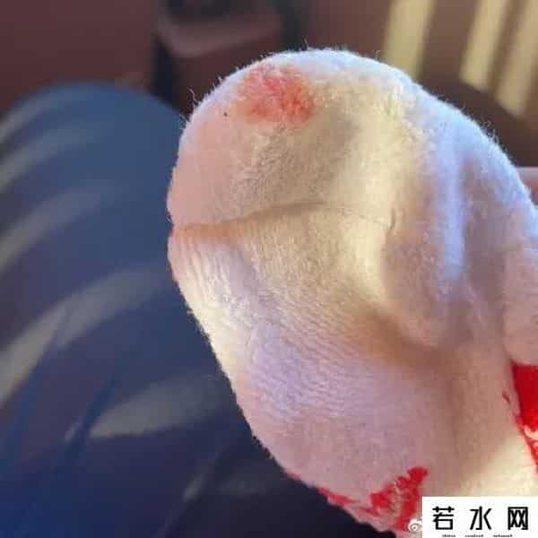 李宁回应鞋子伤脚