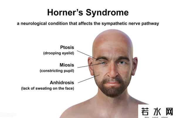 超雄男性长相特点图片