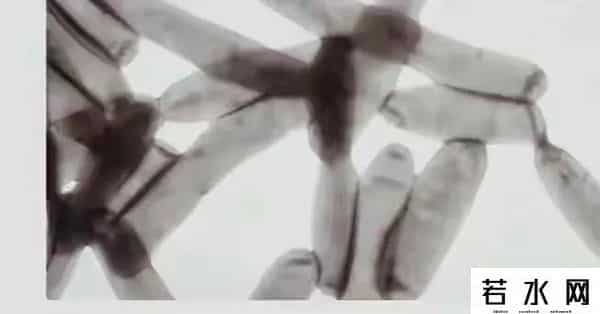 那些被疫情偷走的自由