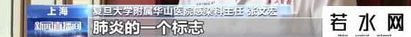 张文宏建议常备血氧仪