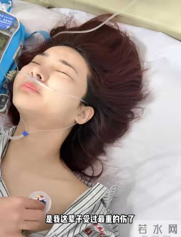 网红跳水粉碎性骨折