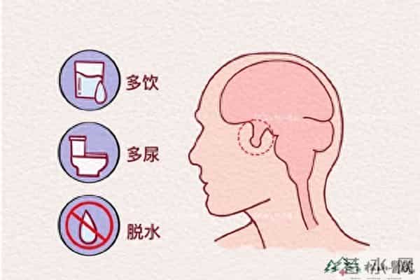 女子每天喝5升水确诊尿崩症