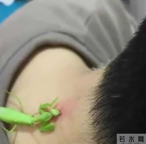 螳螂“大夫”为男子医治脖后瘊子