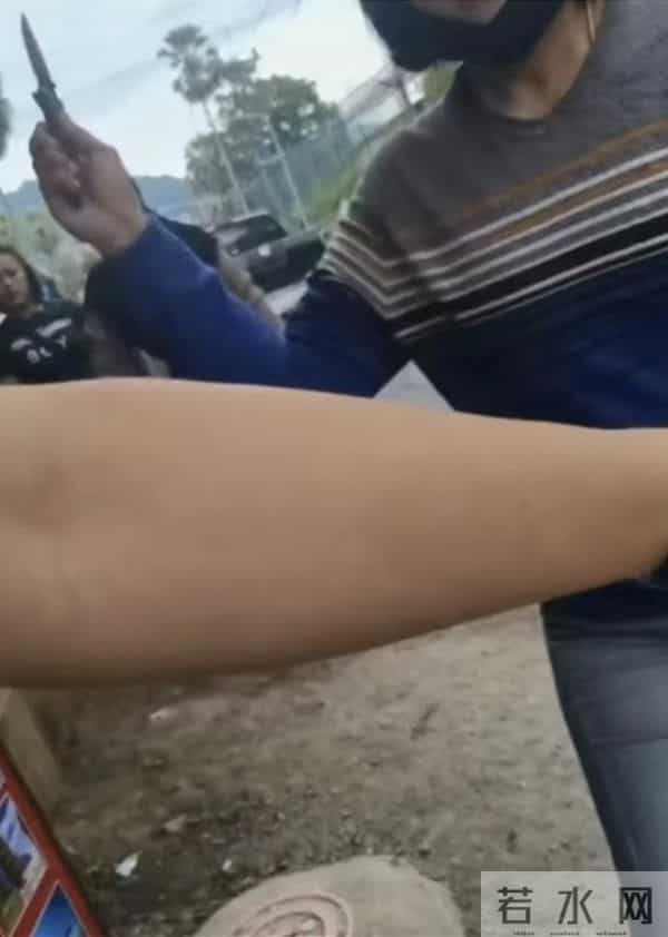 在泰国被割伤中国游客-警察说管不了