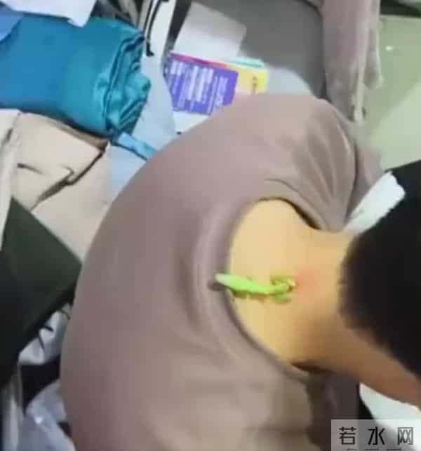 螳螂“大夫”为男子医治脖后瘊子