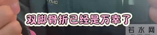 网红跳水粉碎性骨折