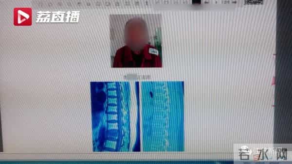 员工参加公司蛙跳游戏致十级伤残