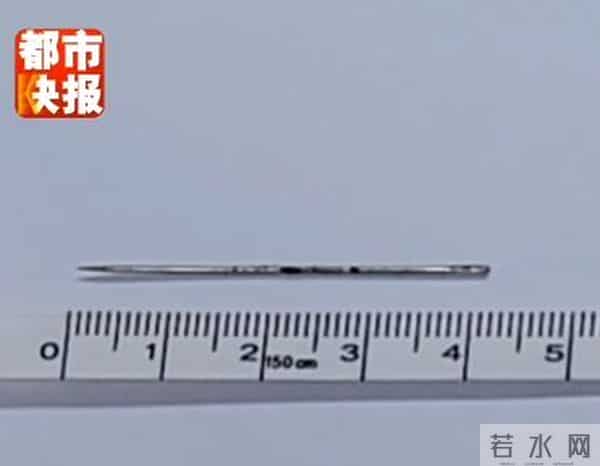 女婴心脏扎进一根4厘米绣花针