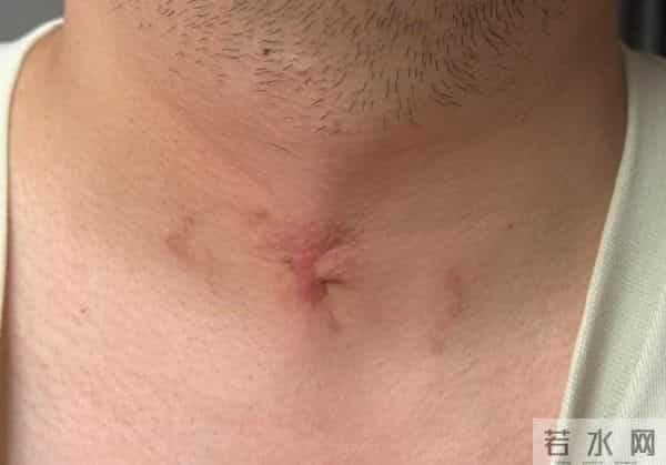 四川一男子在诊所身亡