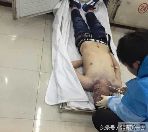 研究生饭局后猝死