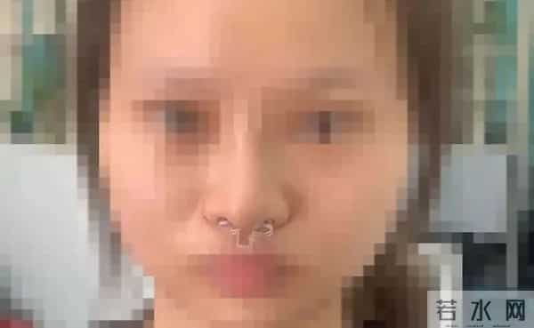 吴凡整容,20岁女孩贷款整形后鼻子歪了，医院医生：“你自己试试用手掰回来”
