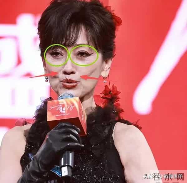 北京这一天71岁赵雅芝生图曝光,鱼尾纹,法令纹藏不住却还在扮嫩