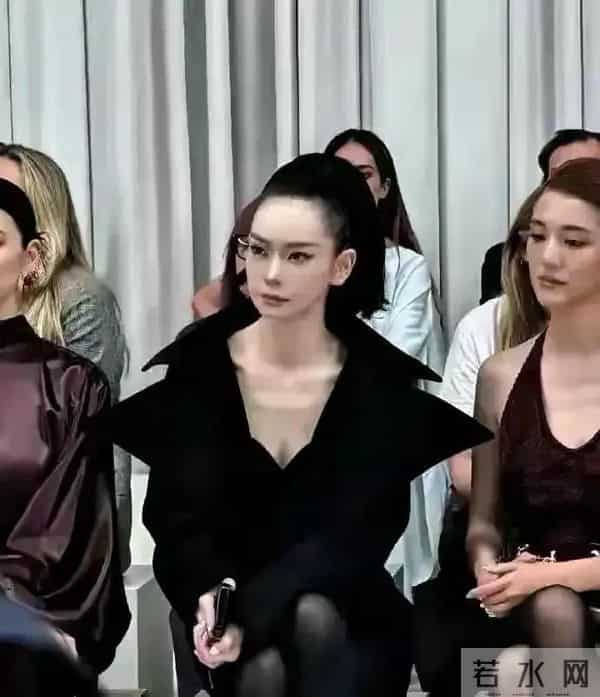 戚薇整个脸做拉皮难道不痛吗?但为了美一切都值得 但发际线有点丑