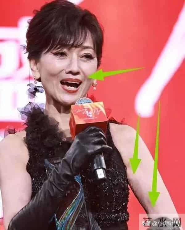 北京这一天71岁赵雅芝生图曝光,鱼尾纹,法令纹藏不住却还在扮嫩