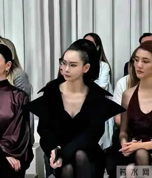 戚薇整个脸做拉皮难道不痛吗?但为了美一切都值得 但发际线有点丑