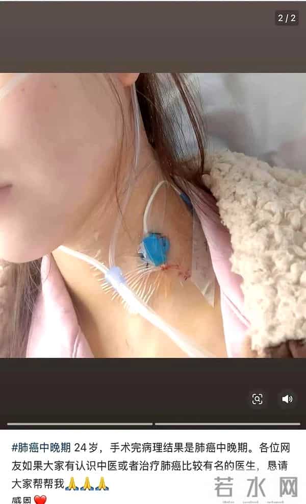 痛心!27岁网红森淼肺癌去世,生前最后动态曝光,这些习惯害了她