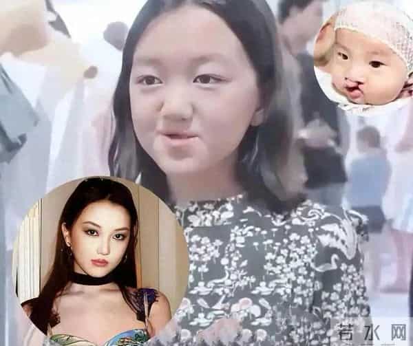 王菲女儿李嫣的兔唇完全消失了！几乎看不出痕迹