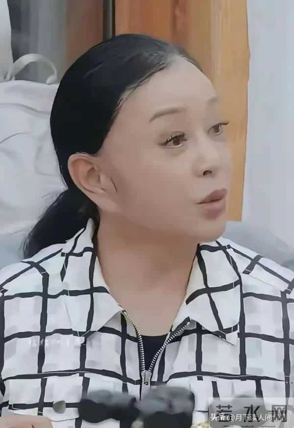 75岁刘晓庆不戴假发好看多了,真面目示人大方自然,秃顶严重老了