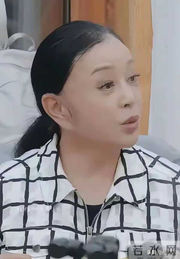 75岁刘晓庆摘掉假发，秃顶白发显岁月痕迹 ，素颜皮肤却嫩过同龄人