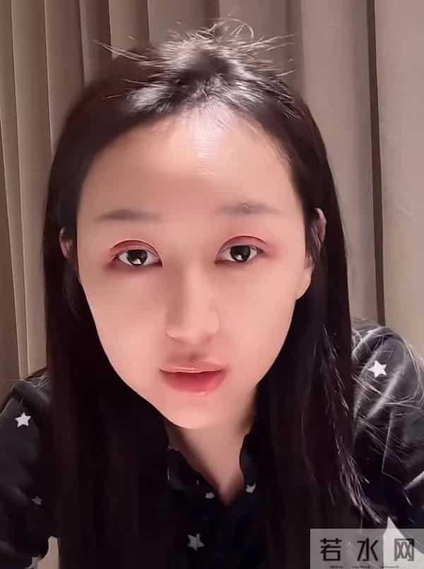 逢思晴与刘程离婚后，做双眼皮变化大，网友称不及以前漂亮了