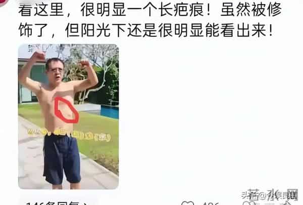 李连杰“脱衣辟谣”上热搜：没换过心脏！揭开“一夜回春”的秘密