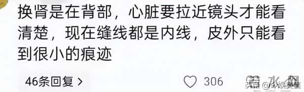 李连杰“脱衣辟谣”上热搜：没换过心脏！揭开“一夜回春”的秘密